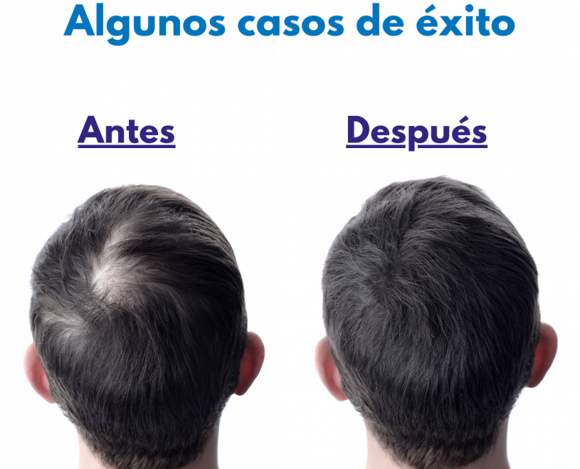 Antes